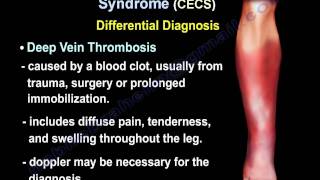 Chronic Exertional Compartment Syndrome  Everything You Need To Know  Dr Nabil Ebraheim [upl. by Hoo]