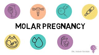 Subchorionic hemorrhage and hematoma in 2nd trimester pregnancy Ultrasound and color Doppler video [upl. by Rochkind]