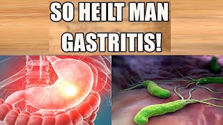 Gastritis heilen Beseitige deine Gastritis schnell und natürlich  Einfaches Heilmittel [upl. by Atworth]