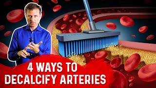 4 Ways To Decalcify Your Arteries – Dr Berg [upl. by Rolat792]