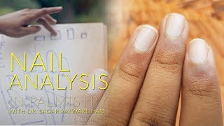 Learn Palmistry  Identifying Different Types of Nails and their Meaning 912 [upl. by Annora]