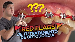 🚩RED FLAGS DE TU TRATAMIENTO DE ORTODONCIA 🚩 COMO SABER SI TUS BRACKETS VAN MAL 👎 [upl. by Camroc]