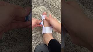 Part 244 FootCare ThumbValgus BigFootBoneProtrusionviralvideoytshorts [upl. by Koval]