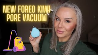 NEW FOREO Kiwi Pore Vacuum  Does it work WHO should use it [upl. by Thatch150]