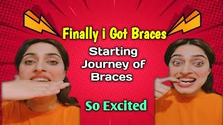 Braces in pakistan  Braces after and before  braces teeth  sobialifestyle [upl. by Williamson]