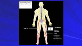 Spinal Decompression Therapy at Sheldon Road Chiropractic amp Massage Therapy [upl. by Leupold987]