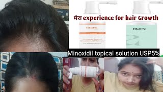 Minoxidil topical solution USP 5 Uses and benefits  hairRegrowthserum honest review [upl. by Xxam]