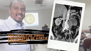 PROTOCOLO DE ANGIOTOMOGRAFIA DE AORTA ABDOMINAL  DIEGO CESAR [upl. by Ettenoj]