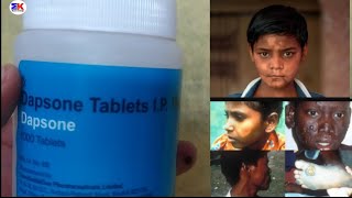 Dapsone 100mg tablets for leprosy and acne treatment Dapsone tabletes uses benefits [upl. by Presber]