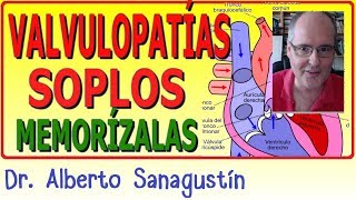 Memoriza las VALVULOPATÍAS y SOPLOS ✅ rápido y fácil [upl. by Zemaj]