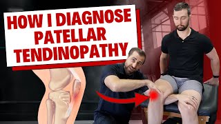 How I Diagnose Patellar Tendinopathy Clinical Examination [upl. by Rabbi241]