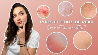 Comment connaître son type  état de peau  Diagnostic conseils et astuces [upl. by Pickens]