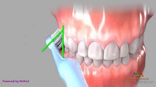 Brushing with Manual Toothbrush  Bass Technique [upl. by Sergu]