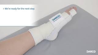 TAS™ Toe Alignment Splint [upl. by Battat]