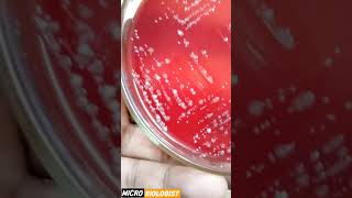 GRAM POSITIVE VS GRAM NEGATIVE BACTERIA GRAM POSITIVE VS GRAM NEGATIVE BACTERIA [upl. by Aikcin272]