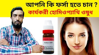 ফর্সা হওয়ার হোমিওপ্যাথিক ঔষধ  Best Homeopathic Medicine For Fairness  Bangla [upl. by Camel33]