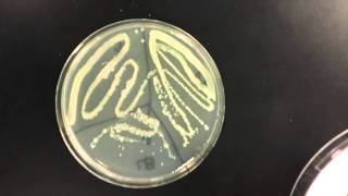 Lab 6 Catalase Test [upl. by Asin]