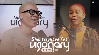 Understanding Albinism  SYV PodcastS1EP2  Ft Jessica Hyacinth [upl. by Assiar70]