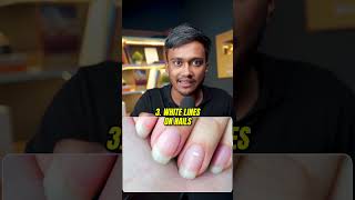 Check Your NAILS NOW shortsindia millionairemindset viralvideo [upl. by Anaeel]