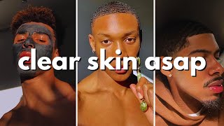 how to get clear skin for guys asap no bs guide [upl. by Nylasoj]