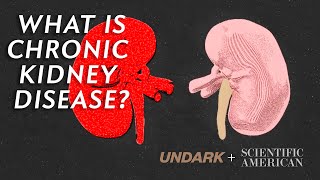 What is Chronic Kidney Disease and how does dialysis work [upl. by Carley]