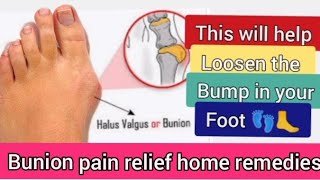 Bunion pain relief home remedies [upl. by Ester30]