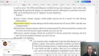 Гистопатологи 4  Nuclear atypia Бөөмийн хэв шинжгүйдэл эсвэл хэв шинжит бус байдал [upl. by Hoashis]