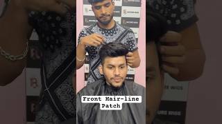 Front Hair Line Patch For Men [upl. by Sumahs]