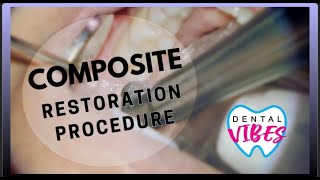 COMPOSITE RESTORATION PROCEDURE  Dental Filling featuring the Solea AllTissue Laser [upl. by Bolan]