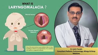 Laryngomalcia Stridor Symptoms Diagnosis amp Treatment I Dr Ankit Parakh Child Pulmonologist [upl. by Call374]