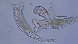 Rotifer Philodina [upl. by Annmarie]