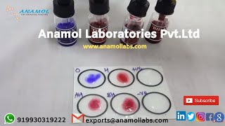 Widal 4x5 ml Test  Widal Test ProcedureIn English [upl. by Alyag]