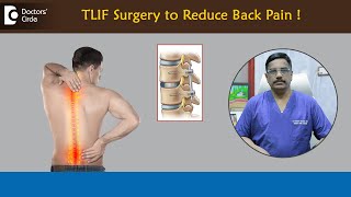 BACK PAIN TLIF Surgery  Transforaminal Lumbar InterbodyDrKodlady Surendra ShettyDoctors Circle [upl. by Mayes]