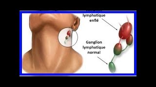 L’inflammation des ganglions lymphatiques  quelle en est la cause [upl. by Ataga]