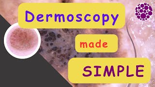 Dermoscopy made simple [upl. by Sowell484]