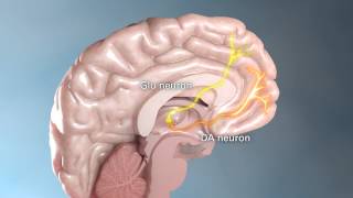 Schizophrenia Part 3 of 4  Medical Animation by Watermark [upl. by Llednek167]