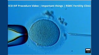 ICSI IVF Procedure Video  Important things  RSMC Fertility Clinic [upl. by Weeks]