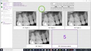 Training XVWeb 20  Acquiring a Continuous Endo Series in XVCapture [upl. by Mohun]