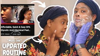 Safe Affordable Quick amp Easy Chemical Peel for Hyperpigmentation  Beginner amp Black Skin Friendly [upl. by Neleb31]