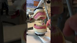 Denture making in prosthodonticsshorts prosthodontics viral trending dentistry bds [upl. by Boyes166]