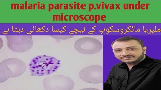 malaria under microscope plasmodium vivax under microscope [upl. by Ahsemat]