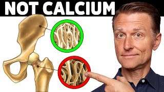 Osteoporosis Is NOT a Calcium Problem [upl. by Tobias]