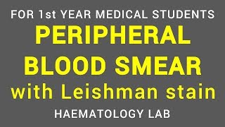 PERIPHERAL BLOOD SMEAR  LEISHMAN STAIN  HAEMATOLOGY LAB  PHYSIOLOGY [upl. by Ahtimat210]