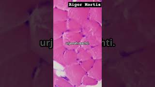 Rigor Mortis मौत के बाद शरीर में क्या होता हैFacts Facts in Hindi shorts facts [upl. by Nniuq]