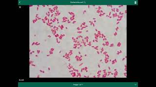 escherichia coli  الإشريكية القولونية [upl. by Hakvir]