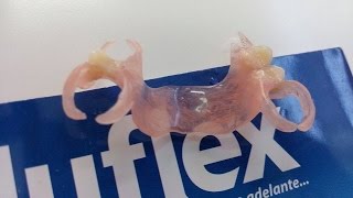 prótese flexivelPrótese flexível Sacavém Próteses dentárias estéticas Lisboasacavém [upl. by Tilden617]