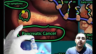 Vaccine for Pancreatic Cancer Treatment Show Promise [upl. by Inattyrb524]