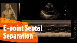 Epoint Septal Separation EPSS Perioperative amp Critical Care ECHO  POCUS [upl. by Nosyaj]