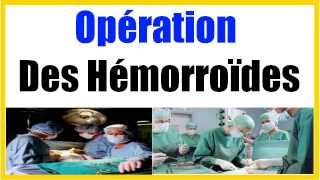 Operation Hemoroide [upl. by Hollerman]