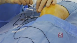 Radio Waves Knock Out Knee Pain [upl. by Ahsias363]